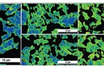 Decohesion and localized plasticity in dual-phase steel due to hydrogen