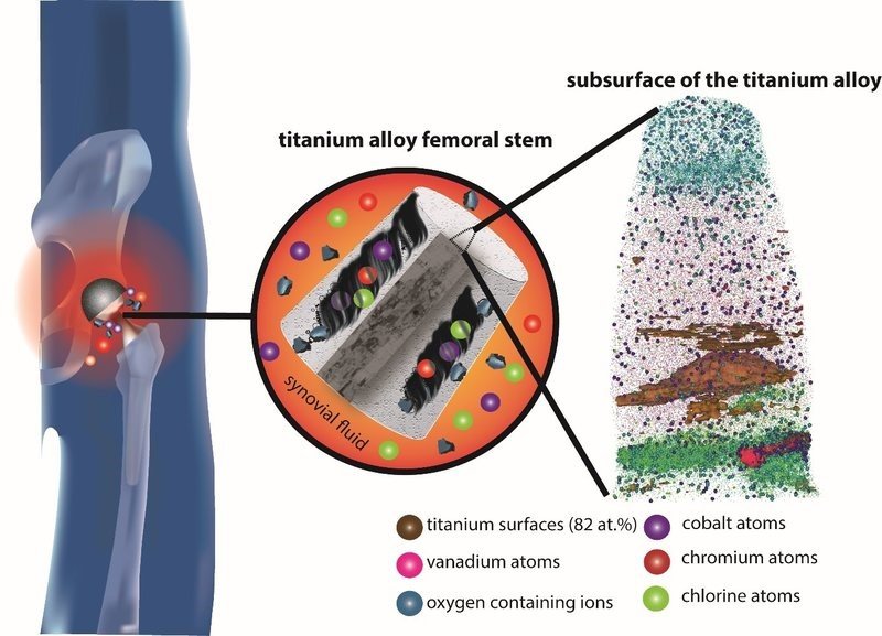 Figure: The titanium alloy hip stem used in total hip replacements, when coupled with a cobalt alloy femoral head, can degrade in the body due to fretting corrosion. From the atom probe tomography reconstruction of the subsurface of the titanium alloy (on the right), the MPIE scientists discovered that surface and subsurface oxides, fragmented titanium particles, the constituent elements of the cobalt alloy (cobalt, chromium) and the interfacial medium (chlorine) are incorporated.