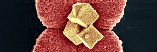 © Thomas Gänsler, Max-Planck-Institut für Eisenforschung GmbH © Thomas Gänsler, Max-Planck-Institut für Eisenforschung GmbH