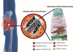 The titanium alloy hip stem used in total hip replacements, when coupled with a cobalt alloy femoral head, can degrade in the body due to fretting corrosion. From the atom probe tomography reconstruction of the subsurface of the titanium alloy (on the right), the MPIE scientists discovered that surface and subsurface oxides, fragmented titanium particles, the constituent elements of the cobalt alloy (cobalt, chromium) and the interfacial medium (chlorine) are incorporated.