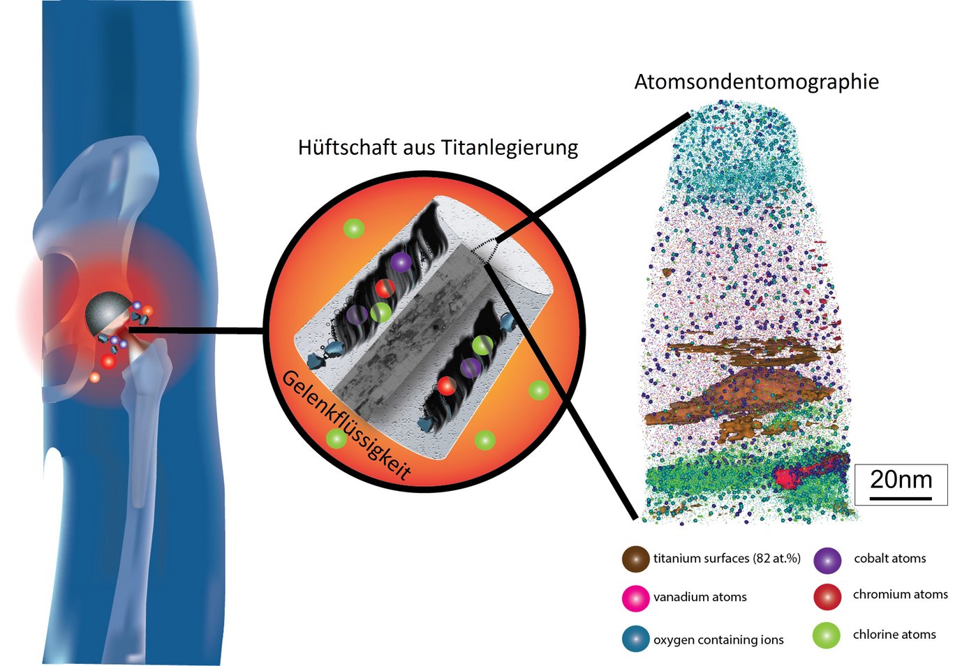 Der kobalthaltige Hüftkopf, der oft bei Hüftendoprothesen verwendet wird, kann sich an der Verbindungstelle zum Hüftschaft aus einer Titanlegierung durch Reibung abbauen. Bei der Messung der Titanlegierung mittels Atomsondentomographie (rechts) entdeckten die Materialwissenschaftlerinnen und -wissenschaftler des MPIE, dass verschiedene Oxide, die Bestandteile der Kobaltlegierung (Kobalt, Chrom) und das Grenzflächenmedium (Chlor) in die Titanoberfläche eingebracht werden.