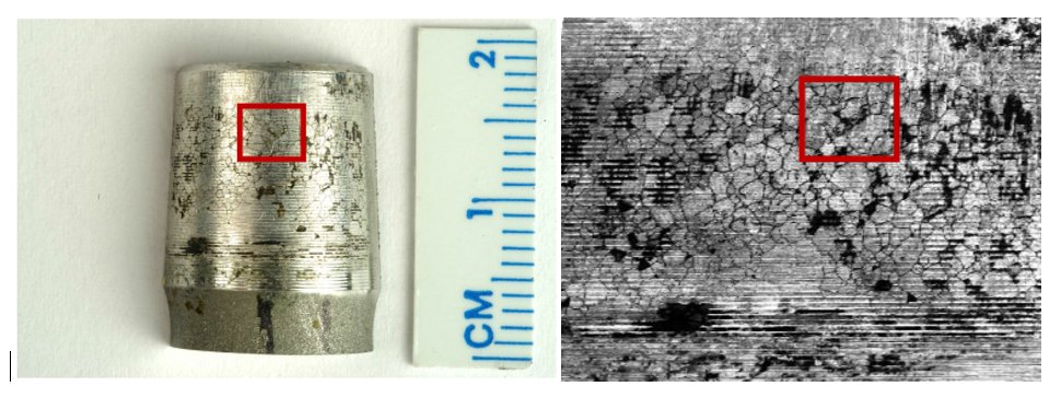 In-vivo grain boundary corrosion that took place in the CoCrmo femoral stem of a total hip replacement implant.