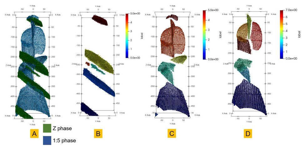 (A) Primary segmentation into distinct chemical phases, without separating individual precipitates. (B) Breaking the "Z phase" into separate precipitates. (C) Breaking the "1:5" phase into separate precipitates. (D) Splitting complex morphologies into interconnected plate-like segments.