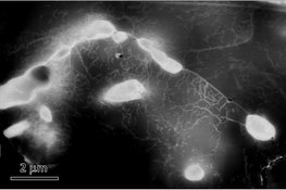 Advanced Microstructural Characterization of in situ Alloyed Nickel-Based Alloys by Welding