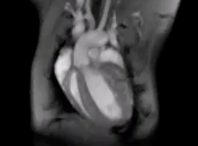 Cardiac regeneration becomes possible