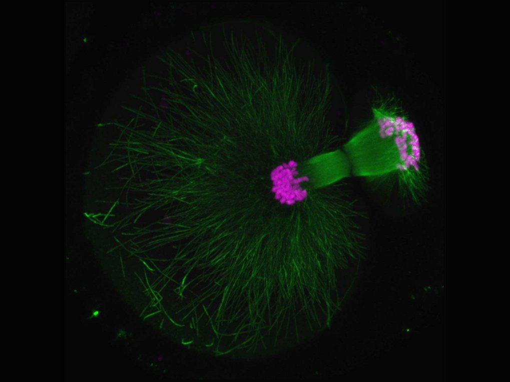 Eine Maus-Eizelle stößt einen sogenannten Polkörper aus. Dieser wichtige Schritt in der Meiose stellt sicher, dass die Eizelle einen einfachen Chromosomensatz enthält. Chromosomen sind in Magenta gefärbt, der Spindelapparat, der die Chromosomenpaare trennt, ist in Grün dargestellt.