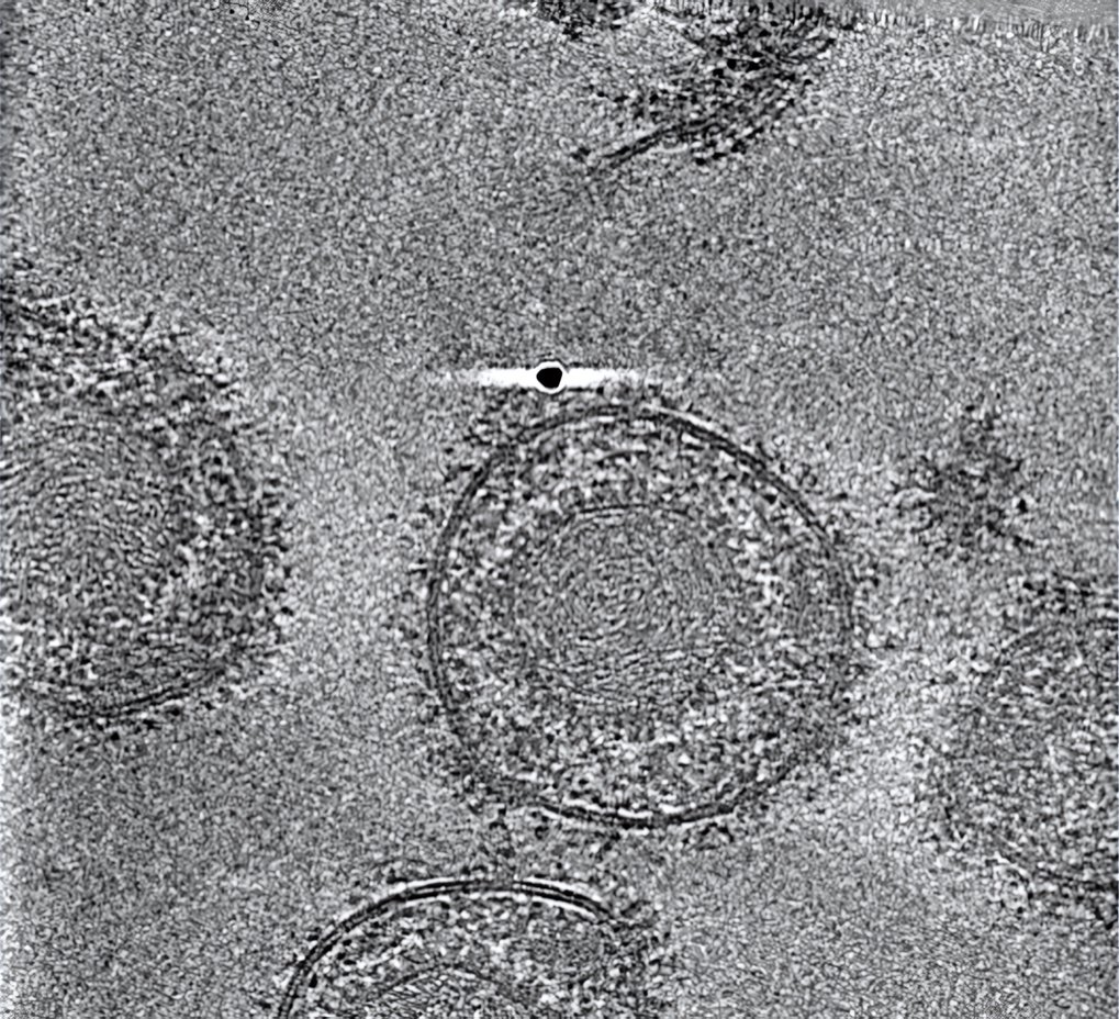Cryo-electron tomography image: The viral membrane is studded with proteins including glycoprotein B that are the key for host cell infection.